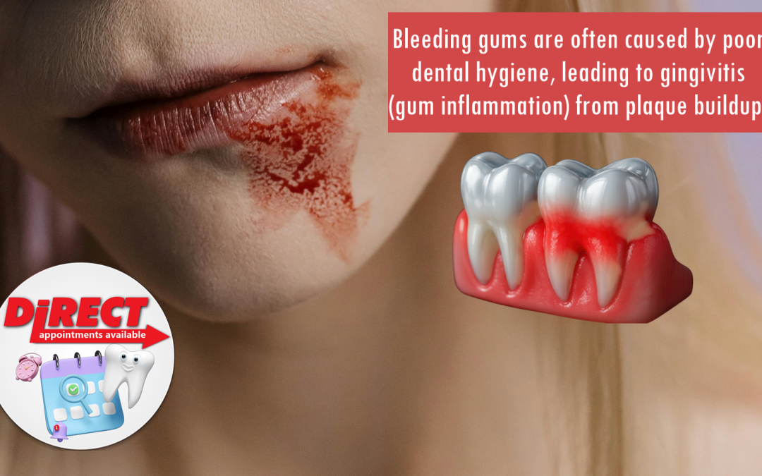 Understanding Gum Disease (Periodontal Disease)