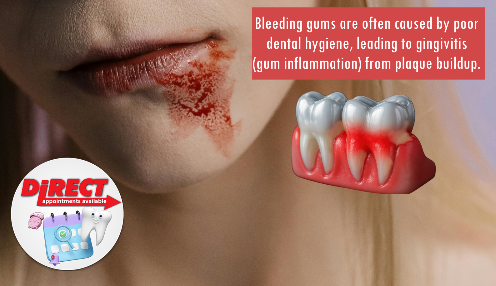 Understanding Gum Disease (Periodontal Disease)