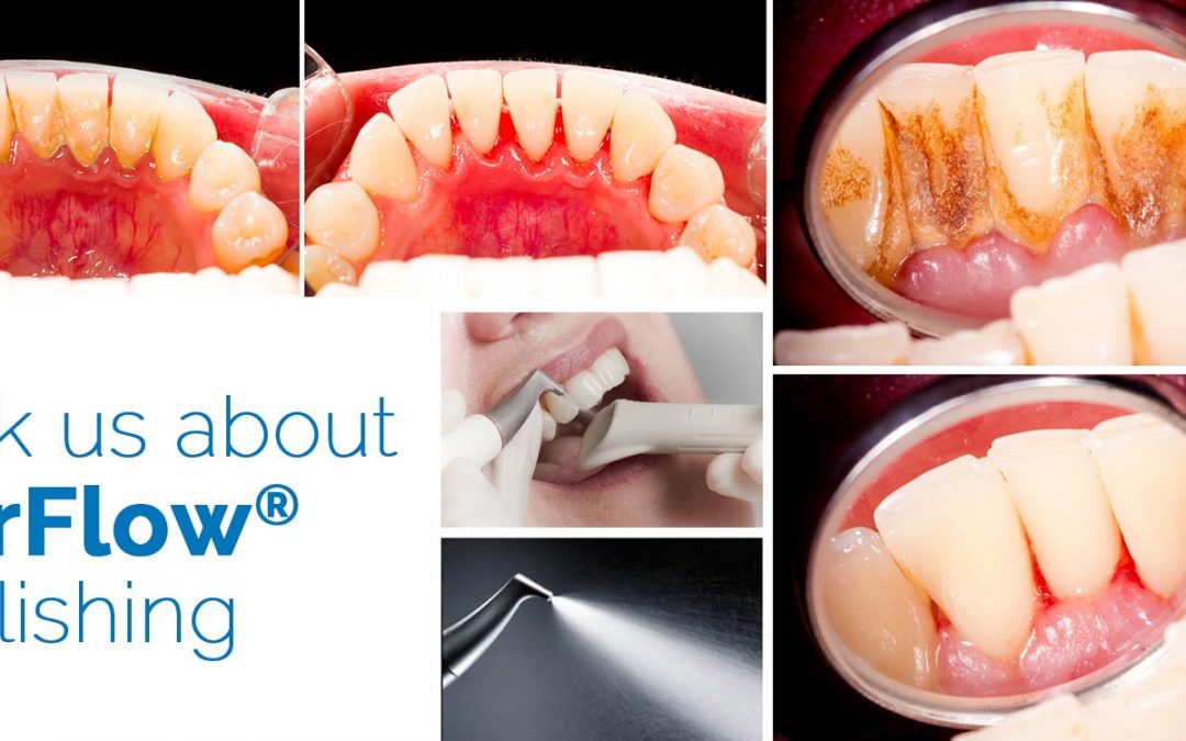 AirFlow Hygiene Stain Removal | Book Online Now