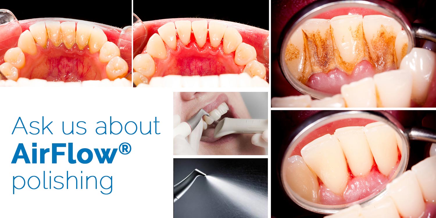 A direct dental hygiene appointment A direct dental hygiene appointment